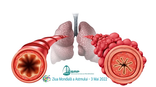 Ziua Mondială a Astmului- vizual SRP
